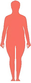 BMI国际WHO标准2类肥胖（重度肥胖）范围35.0 ~ 39.0